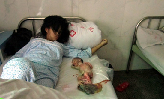 This is a forced abortion in China. Forced abortions in America are equally sad. We must stop them.