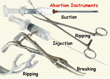 Abortion-Instruments, tools of the trade