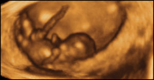 "At 8 weeks, this baby can kick and straighten his legs, and move his arms up and down." (Photo credit: Life Dynamics.
