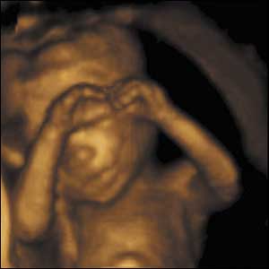 The beauty - and humanity - that ultrasounds show us
