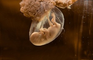 As Americans have seen the baby in the womb, abortion has become more and more distasteful.