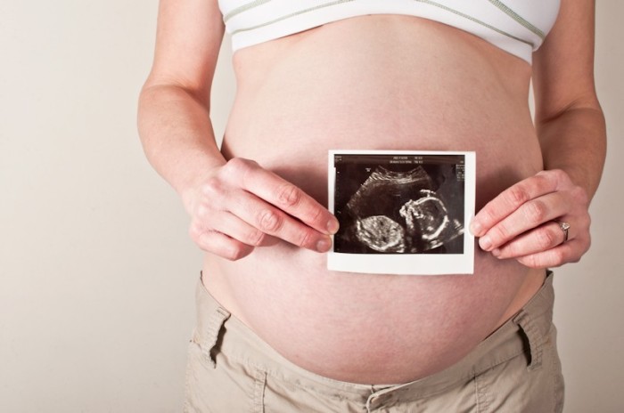 pregnant-ultrasound-fetus2