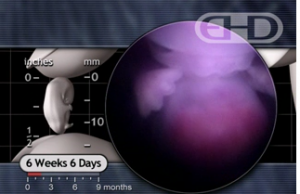 6 week old baby, fetus, embryo
