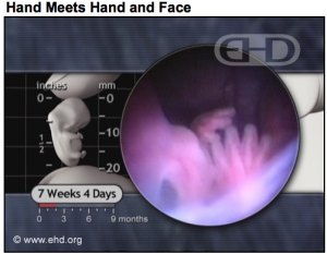 Baby fetus embryo 7 weeks hand face ehd