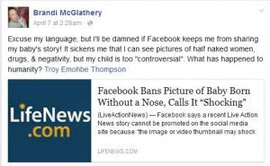 http://blog.lifedynamics.com/mom-reacts-facebook-ban-baby-born-without-nose/