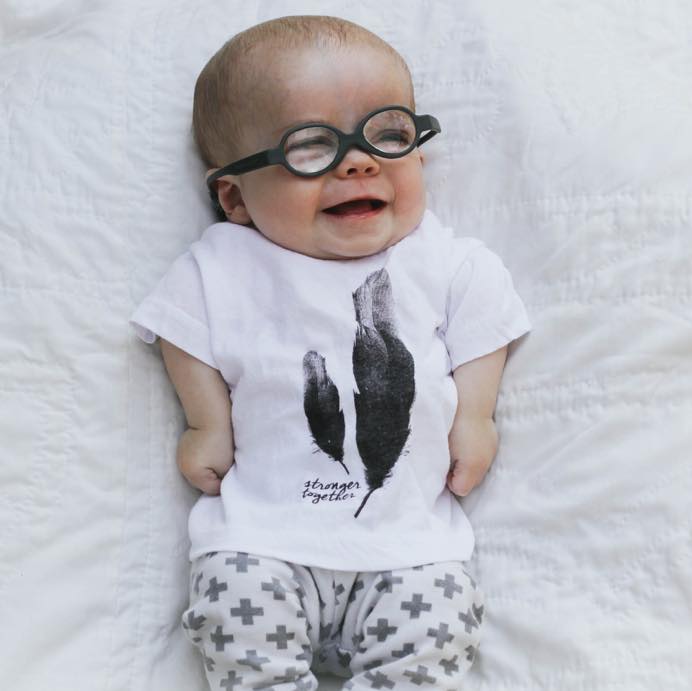 Baby Jude was diagnosed with dwarfism. His parents are continuing to chronicle his amazing journey.