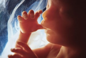 Preborn baby at 20 weeks (Photo credit: http://www.webmd.com/baby/ss/slideshow-fetal-development)