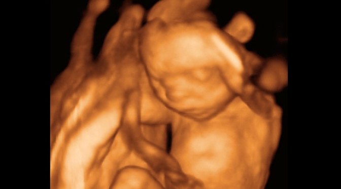 20-wk-ultrasound