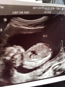 Layla Sky in her ultrasound via Facebook.