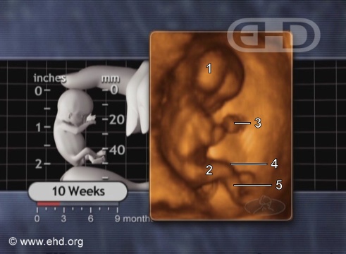 the-1-week-fetus