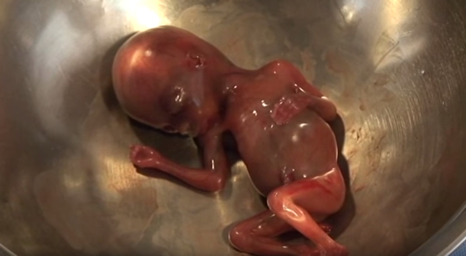 video-fetus