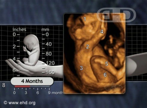 16 week preborn