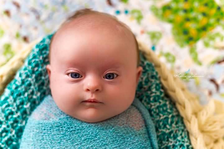 Baby Flynn. copyright: Josee'sJourney.
