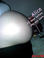 Michelle Olson with unborn Alice
