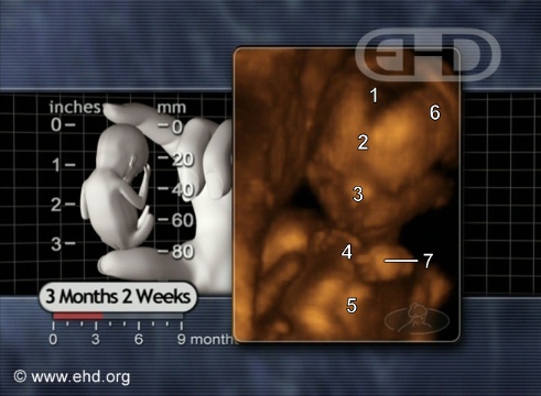the-14-week-fetus